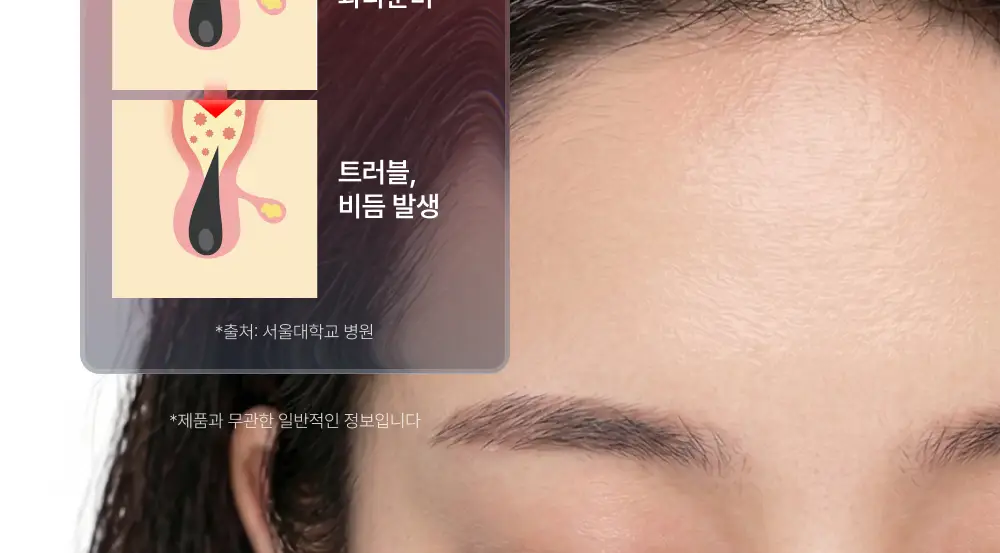 [포켓몬 에디션][비듬/각질케어]릴리이브 스칼프턴 시카 PDRN 딥클린 샴푸 500g 2종 택1 상세페이지 49